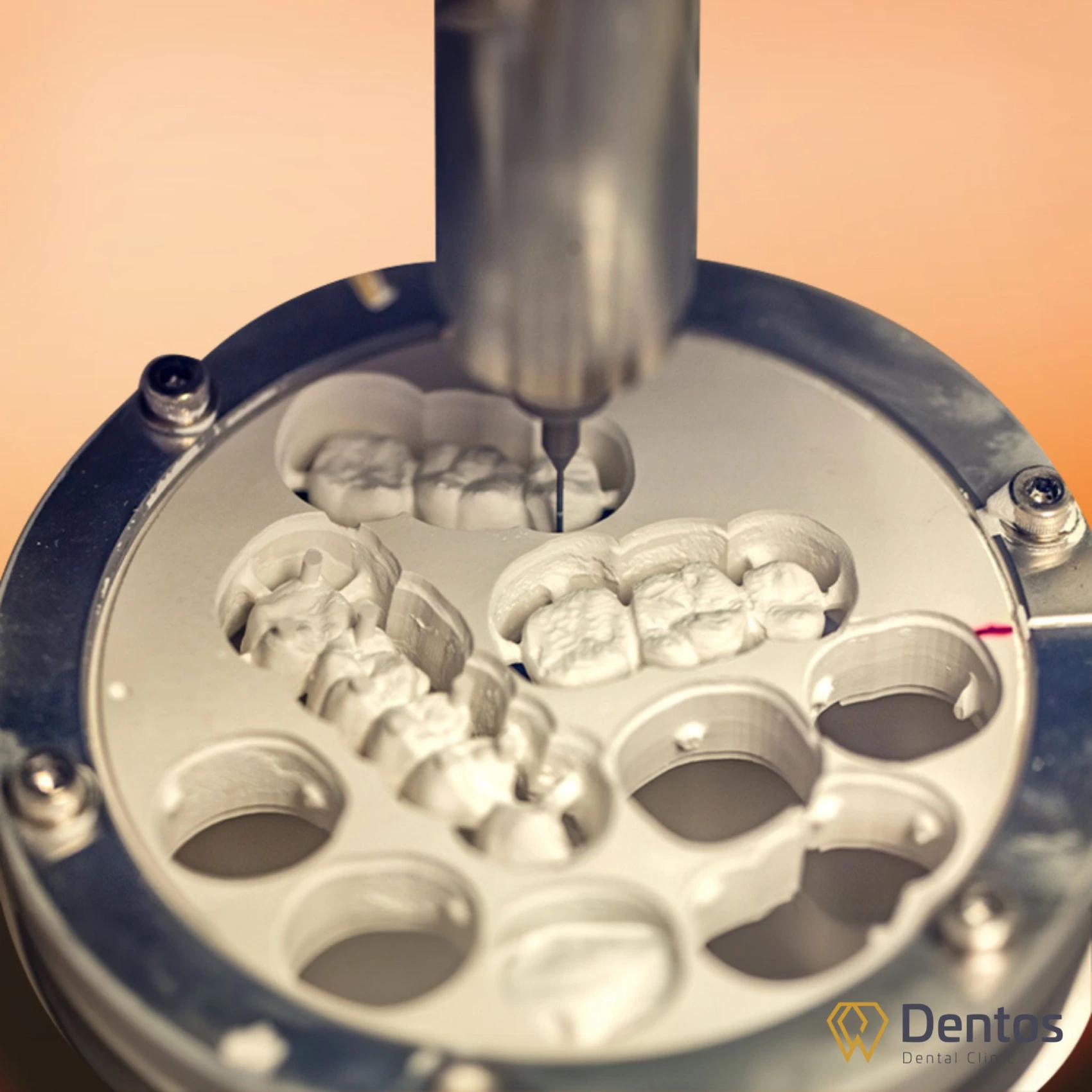 Công nghệ CAD/CAM hiện đại tại Dentos giúp thời gian chế tác được tối ưu hóa